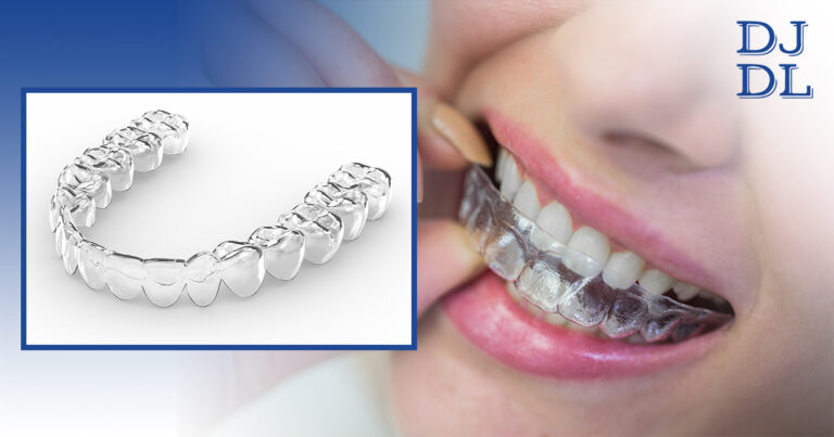 Essix Retainers A Must Have Asset After Braces Blog