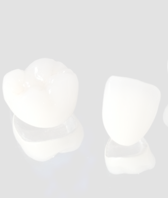 PFM crowns | Dave Johnson Dental Laboratory