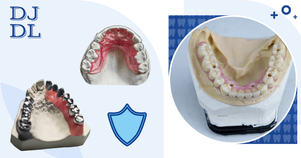 Finding Precision in Prosthetic Dentistry with Custom Trays