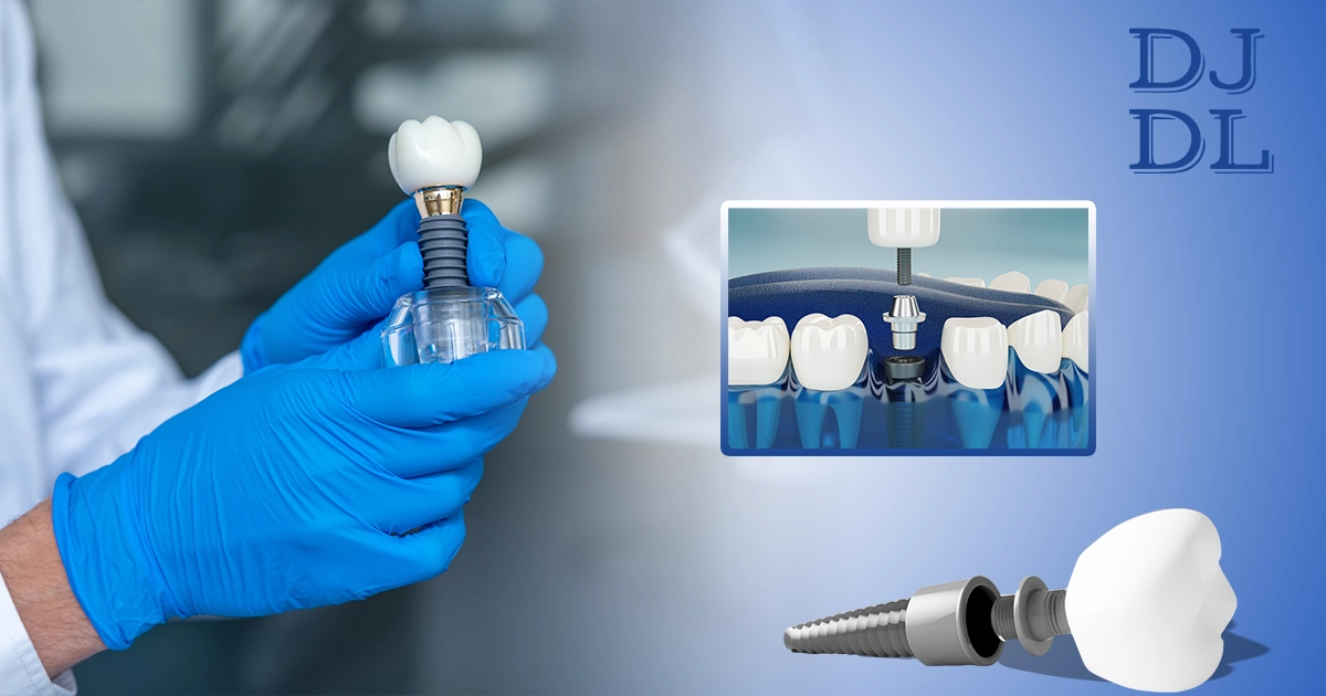 manufacturing-of-implant-crowns-at-lab